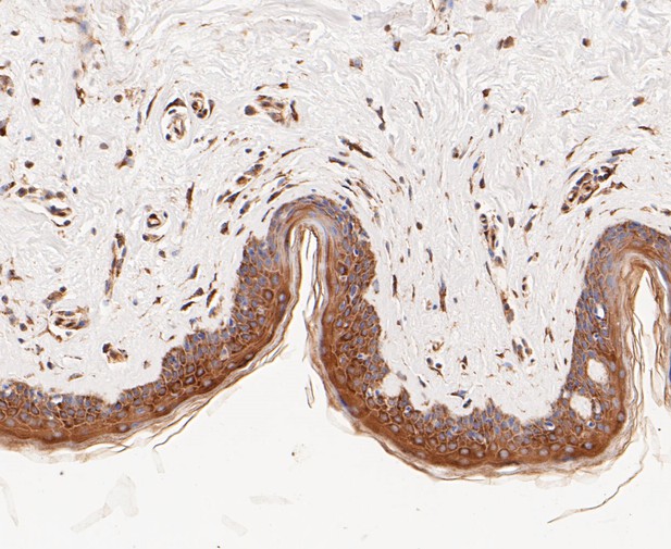 Paraformaldehyde-fixed, paraffin embedded Human skin; Antigen retrieval by boiling in sodium citrate buffer (pH6.0) for 15min; Block endogenous peroxidase by 3% hydrogen peroxide for 20 minutes; Blocking buffer (normal goat serum) at 37°C for 30min; Antibody incubation with TCP1 alpha/CCTA Monoclonal Antibody, Unconjugated (bsm-54666R) at 1:50 for 30 minutes at room temperature, DAB staining.