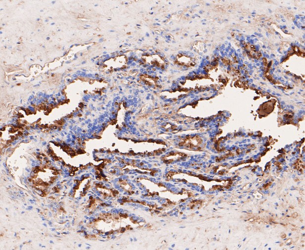 Paraformaldehyde-fixed, paraffin embedded Human seminal vesicle; Antigen retrieval by boiling in sodium citrate buffer (pH6.0) for 15min; Block endogenous peroxidase by 3% hydrogen peroxide for 20 minutes; Blocking buffer (normal goat serum) at 37°C for 30min; Antibody incubation with GCDFP 15 Monoclonal Antibody, Unconjugated (bsm-54667R) at 1:50 for 30 minutes at room temperature, DAB staining.