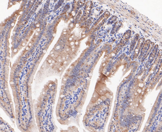Paraformaldehyde-fixed, paraffin embedded Mouse colon; Antigen retrieval by boiling in sodium citrate buffer (pH6.0) for 15min; Block endogenous peroxidase by 3% hydrogen peroxide for 20 minutes; Blocking buffer (normal goat serum) at 37°C for 30min; Antibody incubation with RSK1 p90 Monoclonal Antibody, Unconjugated (bsm-54668R) at 1:200 for 30 minutes at room temperature, DAB staining. Paraformaldehyde-fixed, paraffin embedded Mouse colon; Antigen retrieval by boiling in sodium citrate buffer (pH6.0) for 15min; Block endogenous peroxidase by 3% hydrogen peroxide for 20 minutes; Blocking buffer (normal goat serum) at 37°C for 30min; Antibody incubation with RSK1 p90 Monoclonal Antibody, Unconjugated (bsm-54668R) at 1:200 for 30 minutes at room temperature, DAB staining.