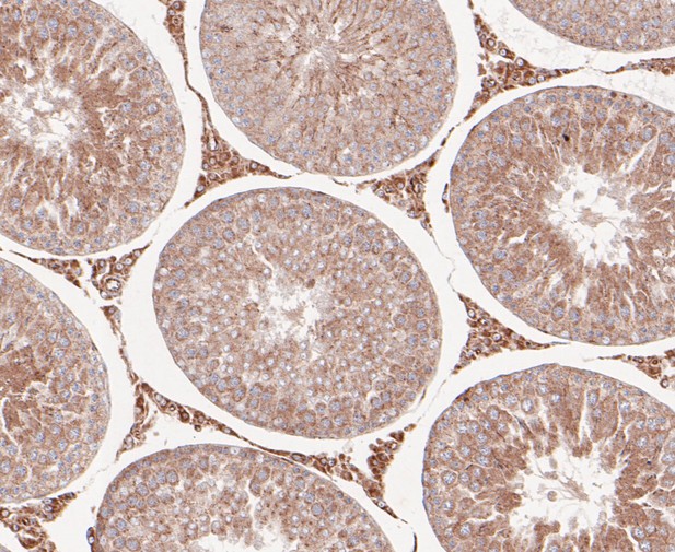 Paraformaldehyde-fixed, paraffin embedded Rat testis; Antigen retrieval by boiling in sodium citrate buffer (pH6.0) for 15min; Block endogenous peroxidase by 3% hydrogen peroxide for 20 minutes; Blocking buffer (normal goat serum) at 37°C for 30min; Antibody incubation with RSK1 p90 Monoclonal Antibody, Unconjugated (bsm-54668R) at 1:50 for 30 minutes at room temperature, DAB staining.