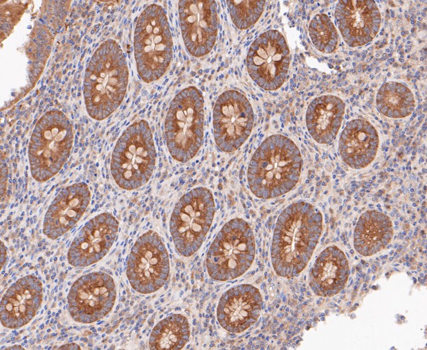 Paraformaldehyde-fixed, paraffin embedded Human appendix; Antigen retrieval by boiling in sodium citrate buffer (pH6.0) for 15min; Block endogenous peroxidase by 3% hydrogen peroxide for 20 minutes; Blocking buffer (normal goat serum) at 37°C for 30min; Antibody incubation with RSK1 p90 Monoclonal Antibody, Unconjugated (bsm-54668R) at 1:200 for 30 minutes at room temperature, DAB staining.