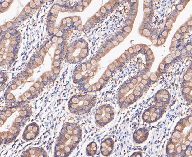 Paraformaldehyde-fixed, paraffin embedded Human intestine; Antigen retrieval by boiling in sodium citrate buffer (pH6.0) for 15min; Block endogenous peroxidase by 3% hydrogen peroxide for 20 minutes; Blocking buffer (normal goat serum) at 37°C for 30min; Antibody incubation with RSK1 p90 Monoclonal Antibody, Unconjugated (bsm-54668R) at 1:200 for 30 minutes at room temperature, DAB staining.