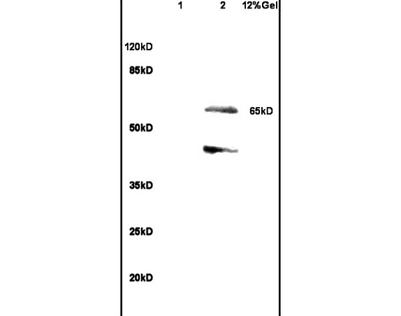 Lane 1: rat heart lysates Lane 2: rat brain lysates probed with Anti SHC3 Polyclonal Antibody, Unconjugated (bs-6199R) at 1:200 in 4˚C. Followed by conjugation to secondary antibody (bs-0295G-HRP) at 1:3000 90min in 37˚C. Predicted band 65kD. Observed band size: 65kD Lane 1: rat heart lysates Lane 2: rat brain lysates probed with Anti SHC3 Polyclonal Antibody, Unconjugated (bs-6199R) at 1:200 in 4˚C. Followed by conjugation to secondary antibody (bs-0295G-HRP) at 1:3000 90min in 37˚C. Predicted band 65kD. Observed band size: 65kD