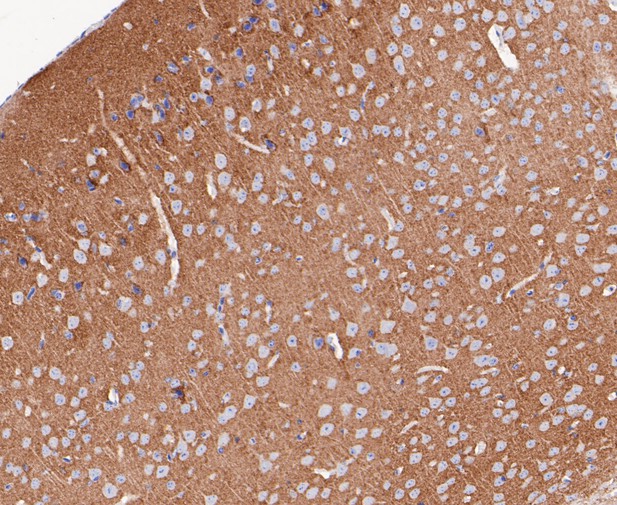 Paraformaldehyde-fixed, paraffin embedded Mouse brain; Antigen retrieval by boiling in sodium citrate buffer (pH6.0) for 15min; Block endogenous peroxidase by 3% hydrogen peroxide for 20 minutes; Blocking buffer (normal goat serum) at 37°C for 30min; Antibody incubation with Synapsin II Monoclonal Antibody, Unconjugated (bsm-54672R) at 1:50 for 30 minutes at room temperature, DAB staining.