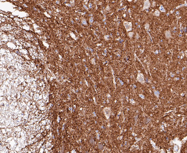 Paraformaldehyde-fixed, paraffin embedded Rat bone marrow; Antigen retrieval by boiling in sodium citrate buffer (pH6.0) for 15min; Block endogenous peroxidase by 3% hydrogen peroxide for 20 minutes; Blocking buffer (normal goat serum) at 37°C for 30min; Antibody incubation with Synapsin II Monoclonal Antibody, Unconjugated (bsm-54672R) at 1:50 for 30 minutes at room temperature, DAB staining.