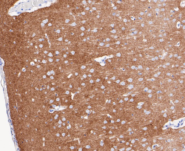 Paraformaldehyde-fixed, paraffin embedded Rat brain; Antigen retrieval by boiling in sodium citrate buffer (pH6.0) for 15min; Block endogenous peroxidase by 3% hydrogen peroxide for 20 minutes; Blocking buffer (normal goat serum) at 37°C for 30min; Antibody incubation with Synapsin II Monoclonal Antibody, Unconjugated (bsm-54672R) at 1:200 for 30 minutes at room temperature, DAB staining.