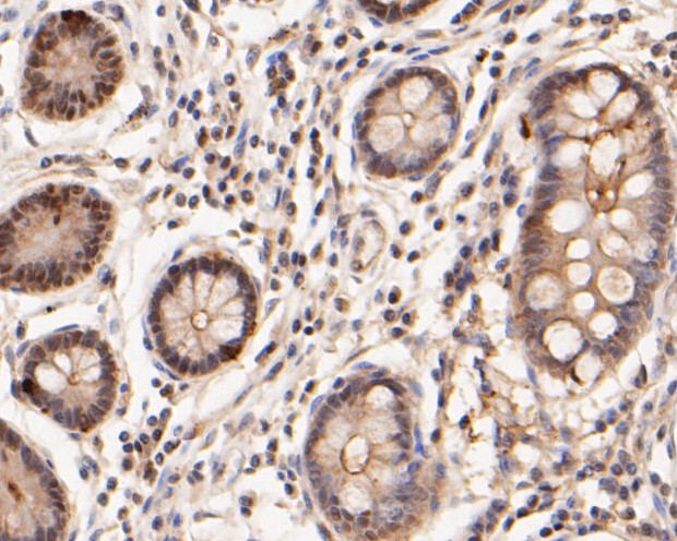 Paraformaldehyde-fixed, paraffin embedded Human intestine; Antigen retrieval by boiling in sodium citrate buffer (pH6.0) for 15min; Block endogenous peroxidase by 3% hydrogen peroxide for 20 minutes; Blocking buffer (normal goat serum) at 37°C for 30min; Antibody incubation with ICAD Monoclonal Antibody, Unconjugated (bsm-54674R) at 1:400 for 30 minutes at room temperature, DAB staining.