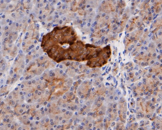 Paraformaldehyde-fixed, paraffin embedded Human pancreas; Antigen retrieval by boiling in sodium citrate buffer (pH6.0) for 15min; Block endogenous peroxidase by 3% hydrogen peroxide for 20 minutes; Blocking buffer (normal goat serum) at 37°C for 30min; Antibody incubation with ICAD Monoclonal Antibody, Unconjugated (bsm-54674R) at 1:400 for 30 minutes at room temperature, DAB staining.