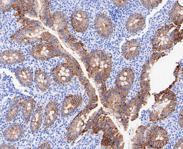 Paraformaldehyde-fixed, paraffin embedded Human appendix; Antigen retrieval by boiling in sodium citrate buffer (pH6.0) for 15min; Block endogenous peroxidase by 3% hydrogen peroxide for 20 minutes; Blocking buffer (normal goat serum) at 37°C for 30min; Antibody incubation with GPA33 Monoclonal Antibody, Unconjugated (bsm-54676R) at 1:50 for 30 minutes at room temperature, DAB staining. Paraformaldehyde-fixed, paraffin embedded Human appendix; Antigen retrieval by boiling in sodium citrate buffer (pH6.0) for 15min; Block endogenous peroxidase by 3% hydrogen peroxide for 20 minutes; Blocking buffer (normal goat serum) at 37°C for 30min; Antibody incubation with GPA33 Monoclonal Antibody, Unconjugated (bsm-54676R) at 1:50 for 30 minutes at room temperature, DAB staining.