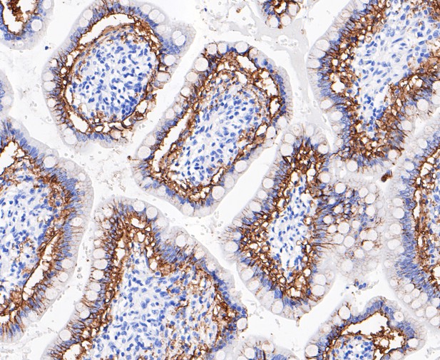 Paraformaldehyde-fixed, paraffin embedded Human intestine; Antigen retrieval by boiling in sodium citrate buffer (pH6.0) for 15min; Block endogenous peroxidase by 3% hydrogen peroxide for 20 minutes; Blocking buffer (normal goat serum) at 37°C for 30min; Antibody incubation with GPA33 Monoclonal Antibody, Unconjugated (bsm-54676R) at 1:200 for 30 minutes at room temperature, DAB staining.