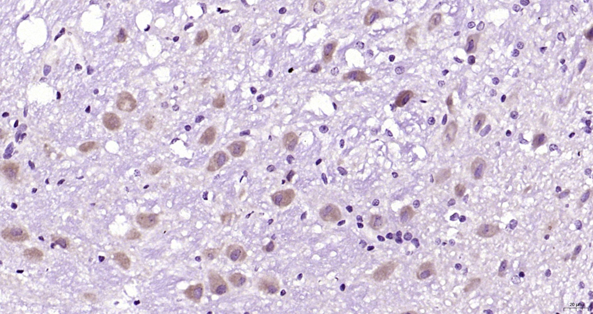 Paraformaldehyde-fixed, paraffin embedded Rat cerebellum; Antigen retrieval by boiling in sodium citrate buffer (pH6.0) for 15min; Block endogenous peroxidase by 3% hydrogen peroxide for 20 minutes; Blocking buffer (normal goat serum) at 37°C for 30min; Antibody incubation with CAPRIN2 Polyclonal Antibody, Unconjugated (bs-12423R) at 1:200 overnight at 4°C, DAB staining.