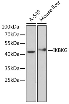 Lane 1: A549 cell lysates; Lane 2: Mouse Liver lysates probed with IKBKG Polyclonal Antibody, Unconjugated (bs-55110R) at 1:1000 dilution and 4˚C overnight incubation. Followed by conjugated secondary antibody incubation at 1:20000 for 60 min at 37˚C. Lane 1: A549 cell lysates; Lane 2: Mouse Liver lysates probed with IKBKG Polyclonal Antibody, Unconjugated (bs-55110R) at 1:1000 dilution and 4˚C overnight incubation. Followed by conjugated secondary antibody incubation at 1:20000 for 60 min at 37˚C.