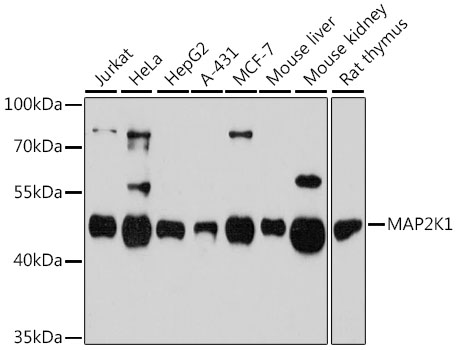 Lane 1: Jurkat cell lysates; Lane 2: Hela cell lysates; Lane 3: HepG2 cell lysates; Lane 4: A431 cell lysates; Lane 5: MCF-7 lysates; Lane 6: Mouse Liver lysates; Lane 7: Mouse Kidney lysates; Lane 8: Rat Thymus lysates probed with MAP2K1 Polyclonal Antibody, Unconjugated (bs-55126R) at 1:1000 dilution and 4˚C overnight incubation. Followed by conjugated secondary antibody incubation at 1:20000 for 60 min at 37˚C.