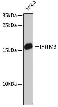 Lane 1: Hela cell lysates probed with IFITM3 Polyclonal Antibody, Unconjugated (bs-55108R) at 1:1000 dilution and 4˚C overnight incubation. Followed by conjugated secondary antibody incubation at 1:20000 for 60 min at 37˚C.