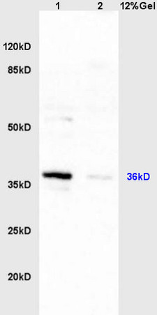 Lane 1: mouse liver lysates Lane 2: mouse intestine lysates probed with Anti HSD17B1/HSD17 Polyclonal Antibody, Unconjugated (bs-6603R) at 1:200 in 4°C. Followed by conjugation to secondary antibody (bs-0295G-HRP) at 1:3000 90min in 37°C. Predicted band 36kD. Observed band size: 36kD