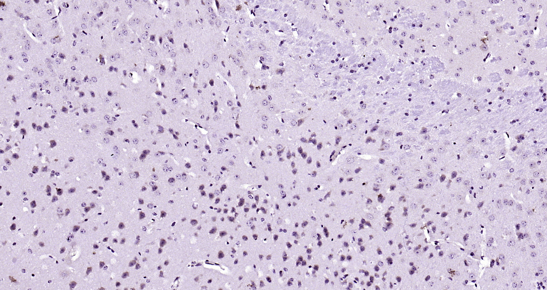 Paraformaldehyde-fixed, paraffin embedded Mouse brain; Antigen retrieval by boiling in sodium citrate buffer (pH6.0) for 15min; Block endogenous peroxidase by 3% hydrogen peroxide for 20 minutes; Blocking buffer (normal goat serum) at 37°C for 30min; Antibody incubation with GSS/Glutathione Synthetase Polyclonal Antibody, Unconjugated (bs-11850R) at 1:200 overnight at 4°C, DAB staining.