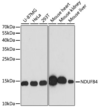 Lane 1: U-87MG cell lysates; Lane 2: Hela cell lysates; Lane 3: 293T cell lysates; Lane 4: Mouse Heart lysates; Lane 5: Mouse Kidney lysates; Lane 6: Mouse Liver lysates probed with NDUFB4 Polyclonal Antibody, Unconjugated (bs-55145R) at 1:1000 dilution and 4˚C overnight incubation. Followed by conjugated secondary antibody incubation at 1:20000 for 60 min at 37˚C.