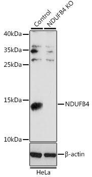 Lane 1: Hela cell lysates; Lane 2: NDUFB4 knockout (KO) HeLa cell lysates probed with NDUFB4 Polyclonal Antibody, Unconjugated (bs-55145R) at 1:1000 dilution and 4˚C overnight incubation. Followed by conjugated secondary antibody incubation at 1:20000 for 60 min at 37˚C.