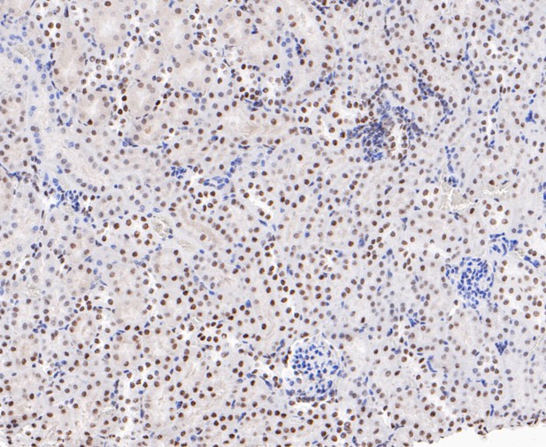 Paraformaldehyde-fixed, paraffin embedded Mouse kidney; Antigen retrieval by boiling in sodium citrate buffer (pH6.0) for 15min; Block endogenous peroxidase by 3% hydrogen peroxide for 20 minutes; Blocking buffer (normal goat serum) at 37°C for 30min; Antibody incubation with EWSR1/EWS Monoclonal Antibody, Unconjugated (bsm-54677R) at 1:200 for 30 minutes at room temperature, DAB staining.