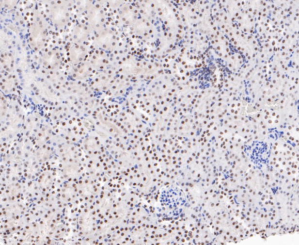 Paraformaldehyde-fixed, paraffin embedded Mouse kidney; Antigen retrieval by boiling in sodium citrate buffer (pH6.0) for 15min; Block endogenous peroxidase by 3% hydrogen peroxide for 20 minutes; Blocking buffer (normal goat serum) at 37°C for 30min; Antibody incubation with EWSR1/EWS Monoclonal Antibody, Unconjugated (bsm-54677R) at 1:200 for 30 minutes at room temperature, DAB staining.