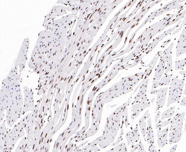 Paraformaldehyde-fixed, paraffin embedded Mouse heart; Antigen retrieval by boiling in sodium citrate buffer (pH6.0) for 15min; Block endogenous peroxidase by 3% hydrogen peroxide for 20 minutes; Blocking buffer (normal goat serum) at 37°C for 30min; Antibody incubation with EWSR1/EWS Monoclonal Antibody, Unconjugated (bsm-54677R) at 1:200 for 30 minutes at room temperature, DAB staining.