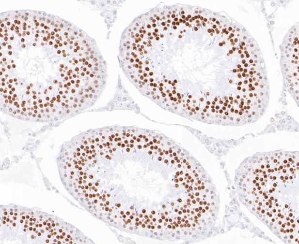 Paraformaldehyde-fixed, paraffin embedded Rat testis; Antigen retrieval by boiling in sodium citrate buffer (pH6.0) for 15min; Block endogenous peroxidase by 3% hydrogen peroxide for 20 minutes; Blocking buffer (normal goat serum) at 37°C for 30min; Antibody incubation with EWSR1/EWS Monoclonal Antibody, Unconjugated (bsm-54677R) at 1:200 for 30 minutes at room temperature, DAB staining.