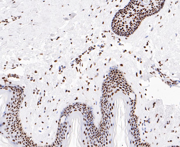 Paraformaldehyde-fixed, paraffin embedded Human skin; Antigen retrieval by boiling in sodium citrate buffer (pH6.0) for 15min; Block endogenous peroxidase by 3% hydrogen peroxide for 20 minutes; Blocking buffer (normal goat serum) at 37°C for 30min; Antibody incubation with EWSR1/EWS Monoclonal Antibody, Unconjugated (bsm-54677R) at 1:50 for 30 minutes at room temperature, DAB staining.