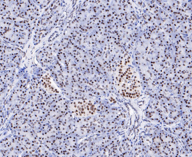 Paraformaldehyde-fixed, paraffin embedded Human pancreas; Antigen retrieval by boiling in sodium citrate buffer (pH6.0) for 15min; Block endogenous peroxidase by 3% hydrogen peroxide for 20 minutes; Blocking buffer (normal goat serum) at 37°C for 30min; Antibody incubation with EWSR1/EWS Monoclonal Antibody, Unconjugated (bsm-54677R) at 1:200 for 30 minutes at room temperature, DAB staining.