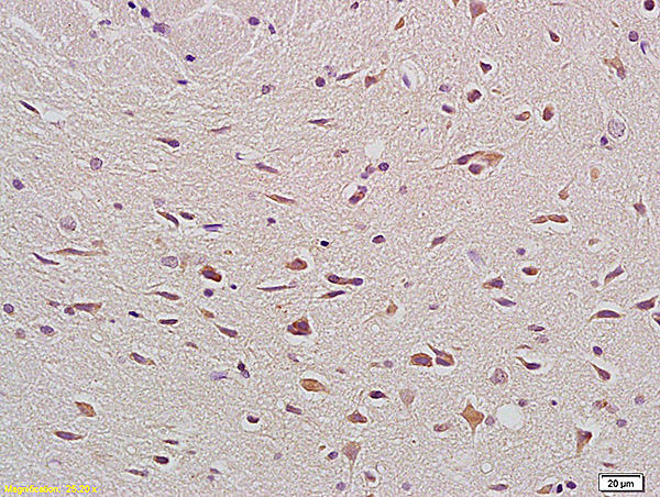 Formalin-fixed and paraffin embedded rat brain labeled with Anti- Bax Polyclonal Antibody, Unconjugated (bs-0127M) at 1:200, followed by conjugation to the secondary antibody and DAB staining.