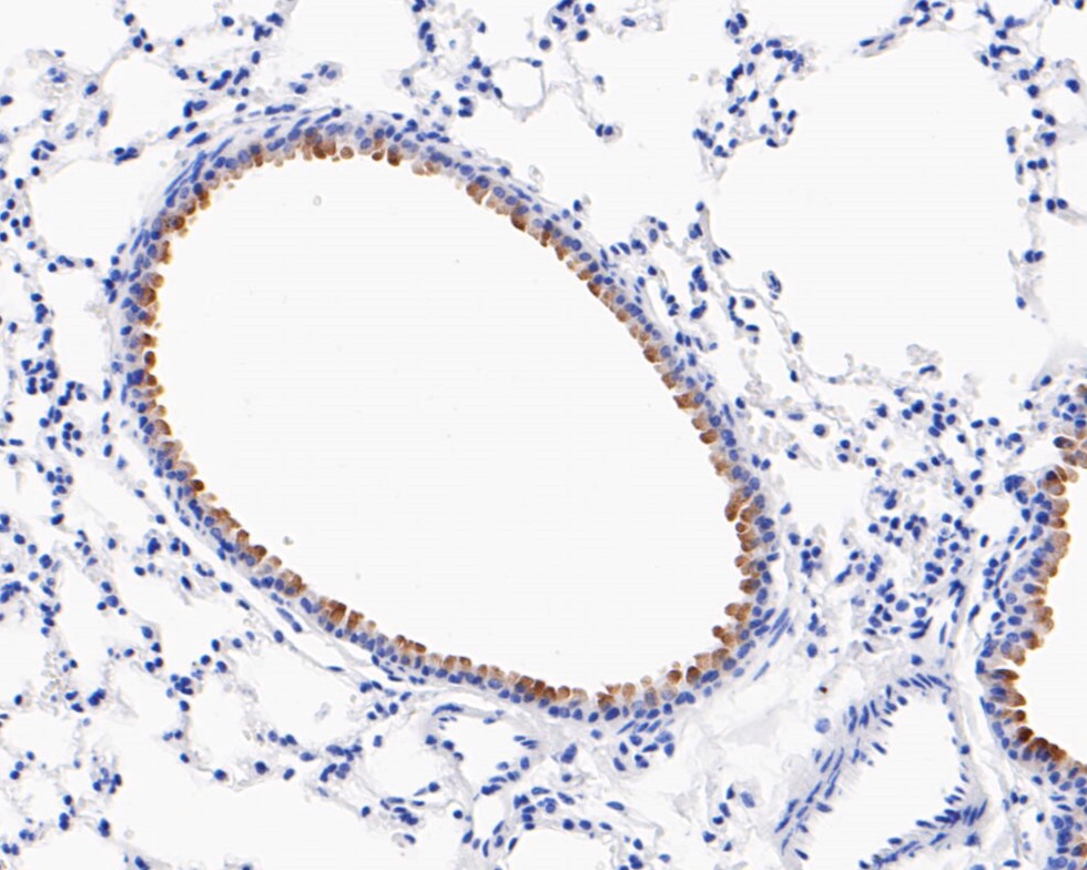 Paraformaldehyde-fixed, paraffin embedded Mouse lung; Antigen retrieval by boiling in sodium citrate buffer (pH6.0) for 15min; Block endogenous peroxidase by 3% hydrogen peroxide for 20 minutes; Blocking buffer (normal goat serum) at 37°C for 30min; Antibody incubation with CD16 Monoclonal Antibody, Unconjugated (bsm-54679R) at 1:50 for 30 minutes at room temperature, DAB staining.