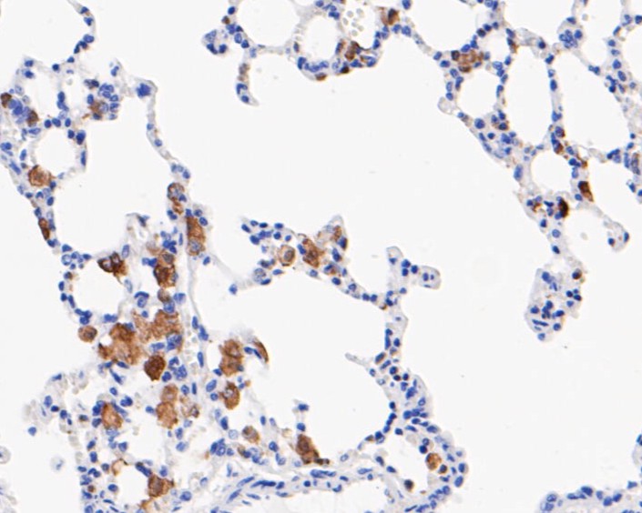 Paraformaldehyde-fixed, paraffin embedded Rat lung; Antigen retrieval by boiling in sodium citrate buffer (pH6.0) for 15min; Block endogenous peroxidase by 3% hydrogen peroxide for 20 minutes; Blocking buffer (normal goat serum) at 37°C for 30min; Antibody incubation with CD16 Monoclonal Antibody, Unconjugated (bsm-54679R) at 1:50 for 30 minutes at room temperature, DAB staining.