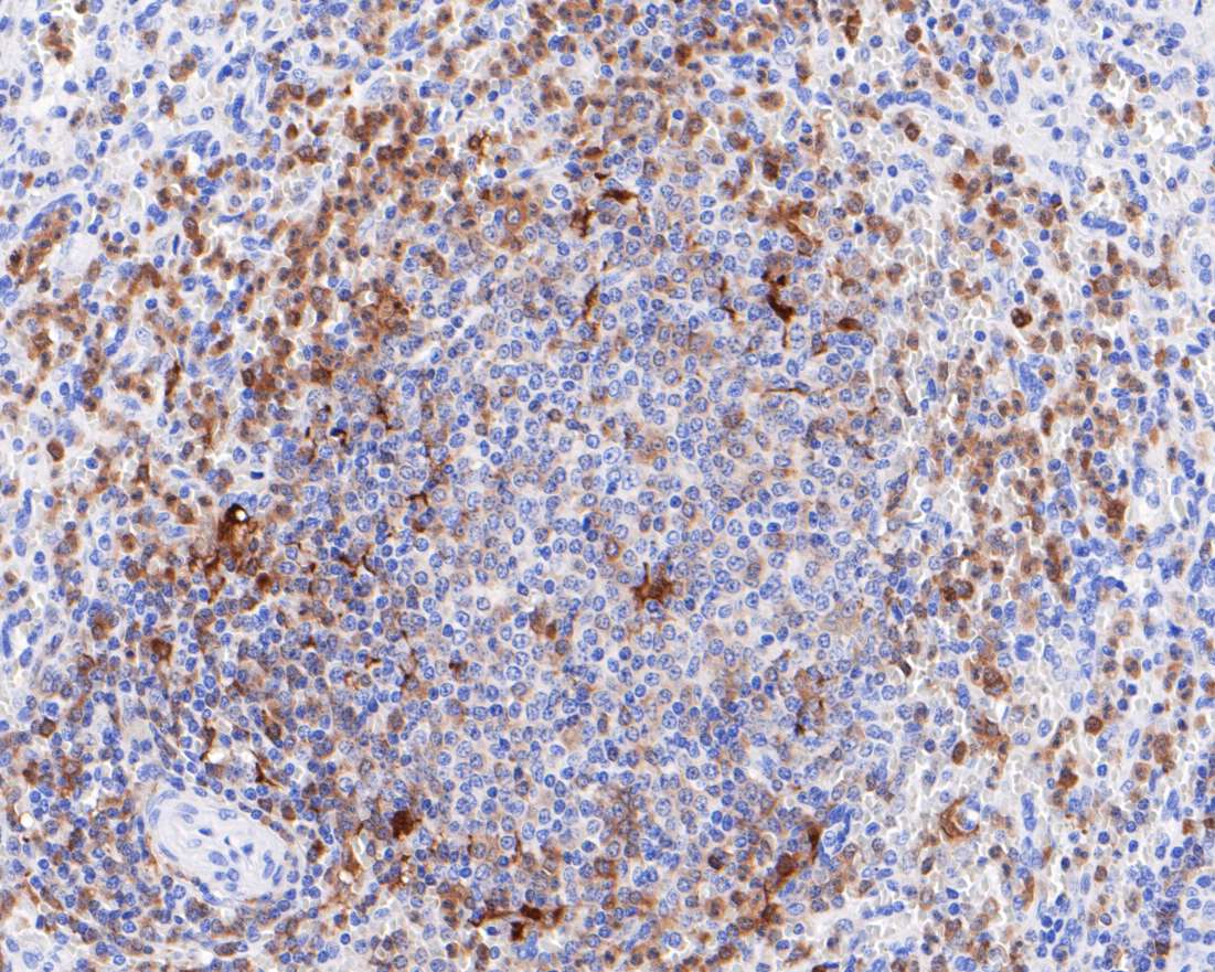 Paraformaldehyde-fixed, paraffin embedded Human spleen; Antigen retrieval by boiling in sodium citrate buffer (pH6.0) for 15min; Block endogenous peroxidase by 3% hydrogen peroxide for 20 minutes; Blocking buffer (normal goat serum) at 37°C for 30min; Antibody incubation with CD16 Monoclonal Antibody, Unconjugated (bsm-54679R) at 1:200 for 30 minutes at room temperature, DAB staining.