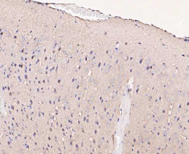 Paraformaldehyde-fixed, paraffin embedded Mouse brain; Antigen retrieval by boiling in sodium citrate buffer (pH6.0) for 15min; Block endogenous peroxidase by 3% hydrogen peroxide for 20 minutes; Blocking buffer (normal goat serum) at 37°C for 30min; Antibody incubation with NRG3 Monoclonal Antibody, Unconjugated (bsm-54680R) at 1:50 for 30 minutes at room temperature, DAB staining.