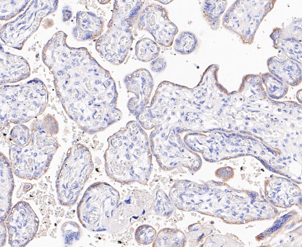 Paraformaldehyde-fixed, paraffin embedded Human placenta; Antigen retrieval by boiling in sodium citrate buffer (pH6.0) for 15min; Block endogenous peroxidase by 3% hydrogen peroxide for 20 minutes; Blocking buffer (normal goat serum) at 37°C for 30min; Antibody incubation with ABAT/GABA-T Monoclonal Antibody, Unconjugated (bsm-54681R) at 1:200 for 30 minutes at room temperature, DAB staining.