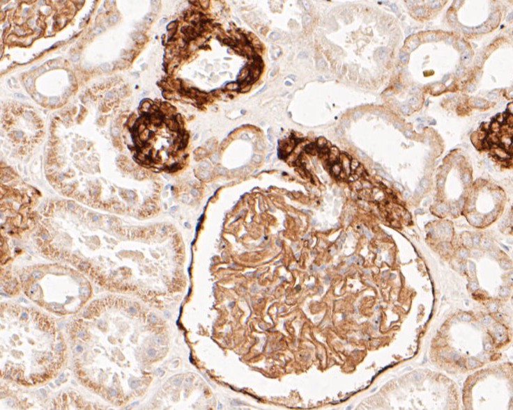 Paraformaldehyde-fixed, paraffin embedded Human kidney; Antigen retrieval by boiling in sodium citrate buffer (pH6.0) for 15min; Block endogenous peroxidase by 3% hydrogen peroxide for 20 minutes; Blocking buffer (normal goat serum) at 37°C for 30min; Antibody incubation with CD239 Monoclonal Antibody, Unconjugated (bsm-54684R) at 1:200 for 30 minutes at room temperature, DAB staining.