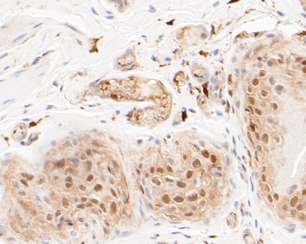 Paraformaldehyde-fixed, paraffin embedded Rat bladder; Antigen retrieval by boiling in sodium citrate buffer (pH6.0) for 15min; Block endogenous peroxidase by 3% hydrogen peroxide for 20 minutes; Blocking buffer (normal goat serum) at 37°C for 30min; Antibody incubation with LTA4H Monoclonal Antibody, Unconjugated (bsm-54689R) at 1:200 for 30 minutes at room temperature, DAB staining.