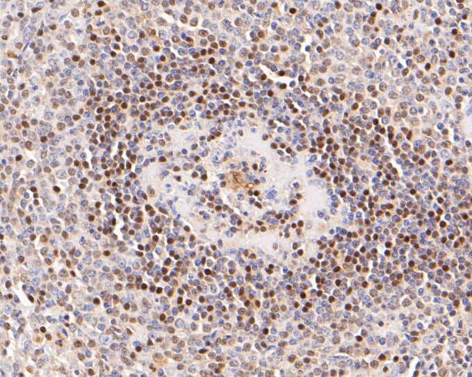 Paraformaldehyde-fixed, paraffin embedded Human tonsil; Antigen retrieval by boiling in sodium citrate buffer (pH6.0) for 15min; Block endogenous peroxidase by 3% hydrogen peroxide for 20 minutes; Blocking buffer (normal goat serum) at 37°C for 30min; Antibody incubation with LTA4H Monoclonal Antibody, Unconjugated (bsm-54689R) at 1:50 for 30 minutes at room temperature, DAB staining.