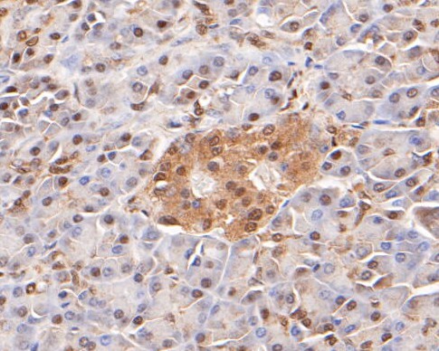 Paraformaldehyde-fixed, paraffin embedded Human pancreas; Antigen retrieval by boiling in sodium citrate buffer (pH6.0) for 15min; Block endogenous peroxidase by 3% hydrogen peroxide for 20 minutes; Blocking buffer (normal goat serum) at 37°C for 30min; Antibody incubation with LTA4H Monoclonal Antibody, Unconjugated (bsm-54689R) at 1:200 for 30 minutes at room temperature, DAB staining.