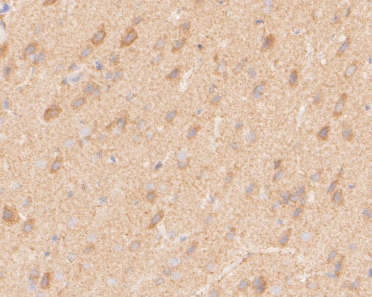 Paraformaldehyde-fixed, paraffin embedded Rat brain; Antigen retrieval by boiling in sodium citrate buffer (pH6.0) for 15min; Block endogenous peroxidase by 3% hydrogen peroxide for 20 minutes; Blocking buffer (normal goat serum) at 37°C for 30min; Antibody incubation with NEK7 Monoclonal Antibody, Unconjugated (bsm-54692R) at 1:200 for 30 minutes at room temperature, DAB staining.