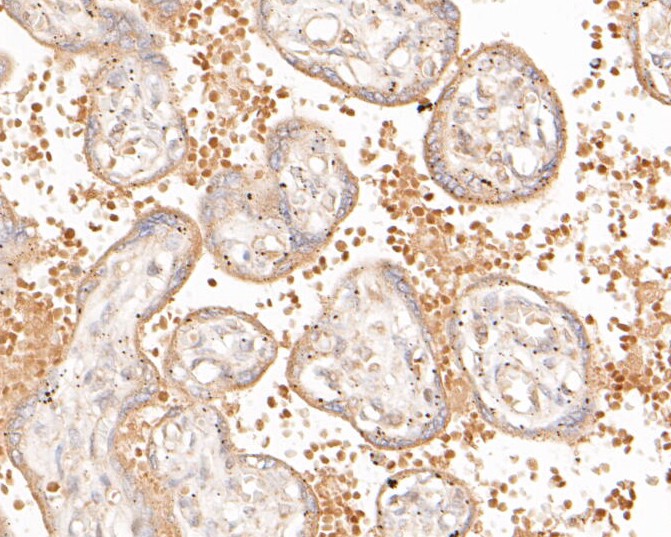 Paraformaldehyde-fixed, paraffin embedded Human placenta; Antigen retrieval by boiling in sodium citrate buffer (pH6.0) for 15min; Block endogenous peroxidase by 3% hydrogen peroxide for 20 minutes; Blocking buffer (normal goat serum) at 37°C for 30min; Antibody incubation with NEK7 Monoclonal Antibody, Unconjugated (bsm-54692R) at 1:200 for 30 minutes at room temperature, DAB staining.