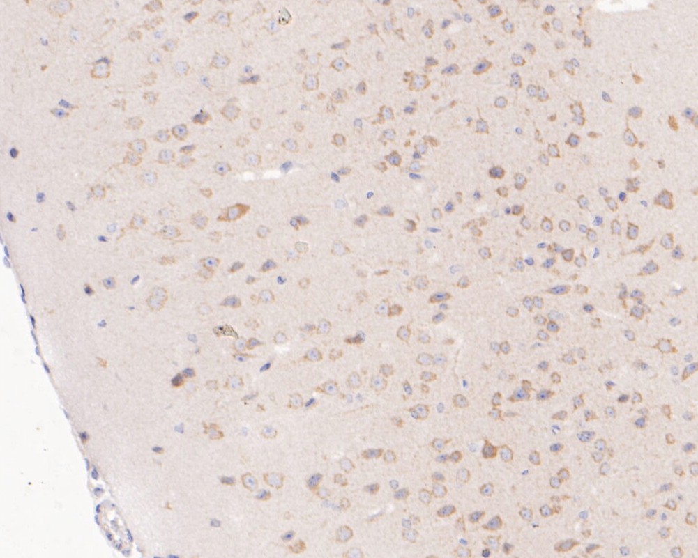 Paraformaldehyde-fixed, paraffin embedded Mouse brain; Antigen retrieval by boiling in sodium citrate buffer (pH6.0) for 15min; Block endogenous peroxidase by 3% hydrogen peroxide for 20 minutes; Blocking buffer (normal goat serum) at 37°C for 30min; Antibody incubation with NUDC Monoclonal Antibody, Unconjugated (bsm-54694R) at 1:200 for 30 minutes at room temperature, DAB staining.