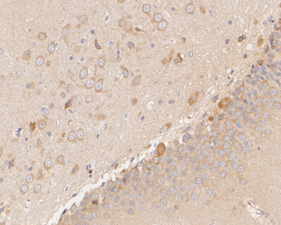 Paraformaldehyde-fixed, paraffin embedded Rat brain; Antigen retrieval by boiling in sodium citrate buffer (pH6.0) for 15min; Block endogenous peroxidase by 3% hydrogen peroxide for 20 minutes; Blocking buffer (normal goat serum) at 37°C for 30min; Antibody incubation with NUDC Monoclonal Antibody, Unconjugated (bsm-54694R) at 1:200 for 30 minutes at room temperature, DAB staining.