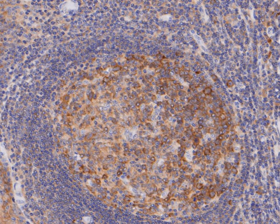 Paraformaldehyde-fixed, paraffin embedded Human tonsil; Antigen retrieval by boiling in sodium citrate buffer (pH6.0) for 15min; Block endogenous peroxidase by 3% hydrogen peroxide for 20 minutes; Blocking buffer (normal goat serum) at 37°C for 30min; Antibody incubation with NUDC Monoclonal Antibody, Unconjugated (bsm-54694R) at 1:200 for 30 minutes at room temperature, DAB staining.