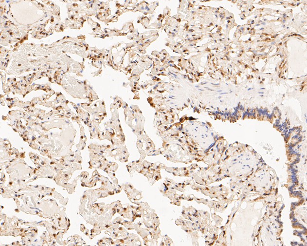 Paraformaldehyde-fixed, paraffin embedded Human lung; Antigen retrieval by boiling in sodium citrate buffer (pH6.0) for 15min; Block endogenous peroxidase by 3% hydrogen peroxide for 20 minutes; Blocking buffer (normal goat serum) at 37°C for 30min; Antibody incubation with PSMA2 Monoclonal Antibody, Unconjugated (bsm-54695R) at 1:50 for 30 minutes at room temperature, DAB staining.