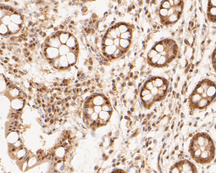 Paraformaldehyde-fixed, paraffin embedded Human intestine; Antigen retrieval by boiling in sodium citrate buffer (pH6.0) for 15min; Block endogenous peroxidase by 3% hydrogen peroxide for 20 minutes; Blocking buffer (normal goat serum) at 37°C for 30min; Antibody incubation with PSMA2 Monoclonal Antibody, Unconjugated (bsm-54695R) at 1:50 for 30 minutes at room temperature, DAB staining.