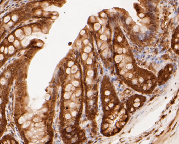 Paraformaldehyde-fixed, paraffin embedded Rat colon; Antigen retrieval by boiling in sodium citrate buffer (pH6.0) for 15min; Block endogenous peroxidase by 3% hydrogen peroxide for 20 minutes; Blocking buffer (normal goat serum) at 37°C for 30min; Antibody incubation with PSMA3 Monoclonal Antibody, Unconjugated (bsm-54696R) at 1:50 for 30 minutes at room temperature, DAB staining.