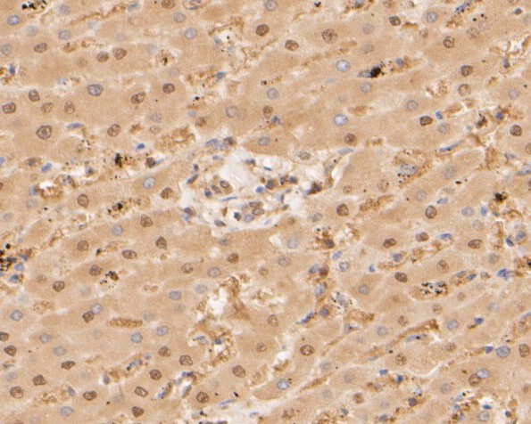 Paraformaldehyde-fixed, paraffin embedded Human liver; Antigen retrieval by boiling in sodium citrate buffer (pH6.0) for 15min; Block endogenous peroxidase by 3% hydrogen peroxide for 20 minutes; Blocking buffer (normal goat serum) at 37°C for 30min; Antibody incubation with PSMA3 Monoclonal Antibody, Unconjugated (bsm-54696R) at 1:50 for 30 minutes at room temperature, DAB staining.