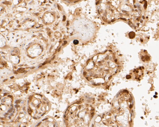 Paraformaldehyde-fixed, paraffin embedded Human placenta; Antigen retrieval by boiling in sodium citrate buffer (pH6.0) for 15min; Block endogenous peroxidase by 3% hydrogen peroxide for 20 minutes; Blocking buffer (normal goat serum) at 37°C for 30min; Antibody incubation with PSMA3 Monoclonal Antibody, Unconjugated (bsm-54696R) at 1:50 for 30 minutes at room temperature, DAB staining.