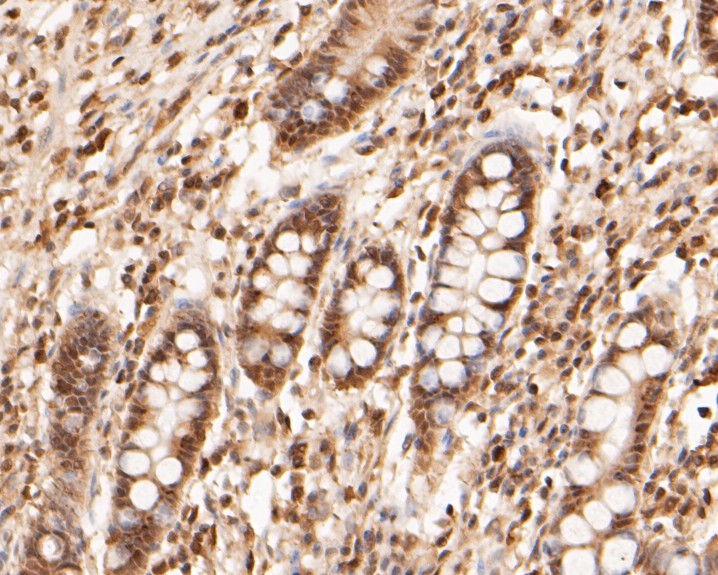 Paraformaldehyde-fixed, paraffin embedded Human intestine; Antigen retrieval by boiling in sodium citrate buffer (pH6.0) for 15min; Block endogenous peroxidase by 3% hydrogen peroxide for 20 minutes; Blocking buffer (normal goat serum) at 37°C for 30min; Antibody incubation with WAPL Monoclonal Antibody, Unconjugated (bsm-54699R) at 1:100 for 30 minutes at room temperature, DAB staining.