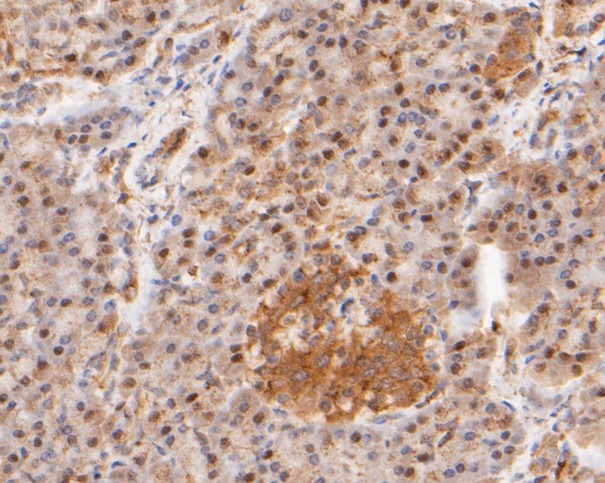 Paraformaldehyde-fixed, paraffin embedded Human pancreas; Antigen retrieval by boiling in sodium citrate buffer (pH6.0) for 15min; Block endogenous peroxidase by 3% hydrogen peroxide for 20 minutes; Blocking buffer (normal goat serum) at 37°C for 30min; Antibody incubation with WAPL Monoclonal Antibody, Unconjugated (bsm-54699R) at 1:100 for 30 minutes at room temperature, DAB staining.